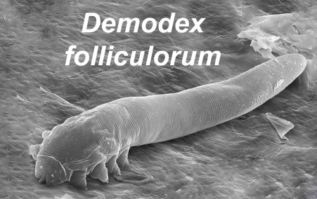 Scanning electron micrograph of a Demodex folliculorum mite